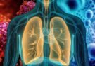How to Know If You Have Walking Pneumonia