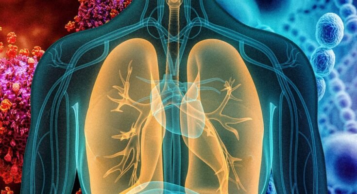 How to Know If You Have Walking Pneumonia