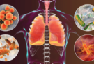 How to Know If You Have Walking Pneumonia